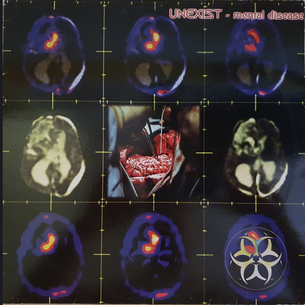 Mental Disease front cover